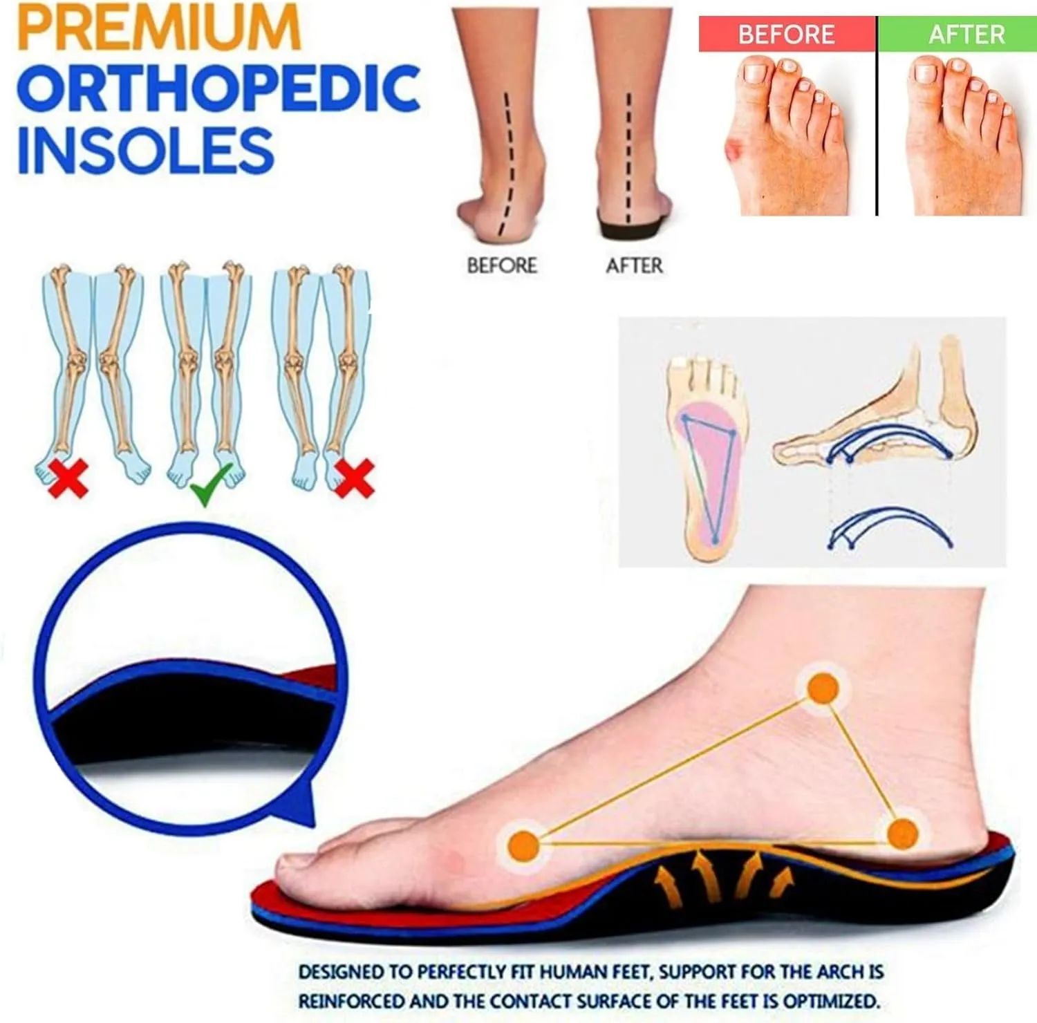 Clogs for Women Wide Width Wedge Sandals Hollow Out Closed Toe Slip On Slippers Arch Support Outdoor Beach Slippers